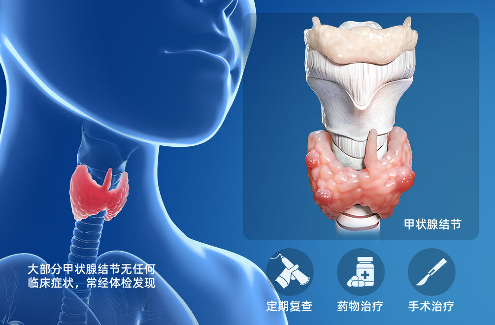 甲状腺结节